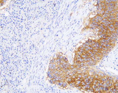 EGFR(C1E7),MMab