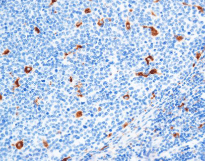 CD68(C2F10),MMab