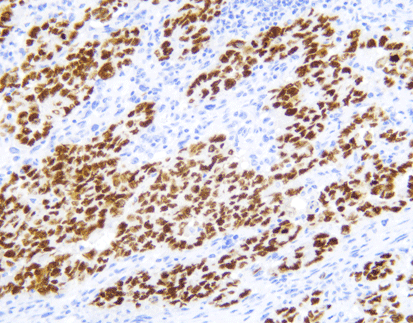 SALL4 (C2E8),MMab