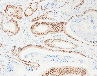 CDX-2(C2X5),RMab
