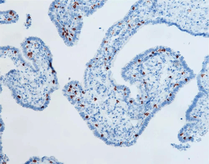 CD3(C3E7),MMab