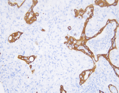 Cytokeratin 8(C7E10),MMab