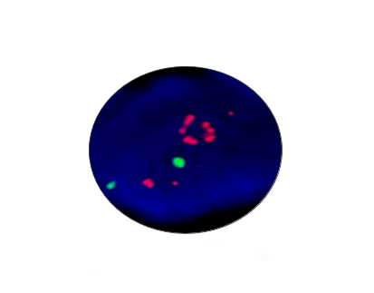 C-MET Gene Amplification Detection Kit