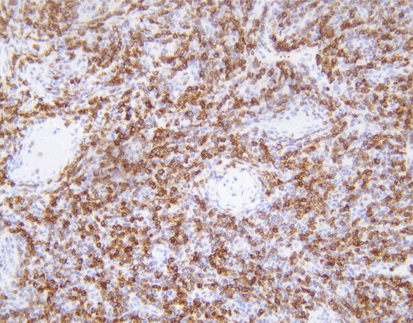 Bcl-2(C7B8),MMab
