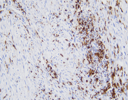 CD68(C2F10),MMab