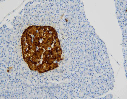 Chromogranin A (C1E8),MMab