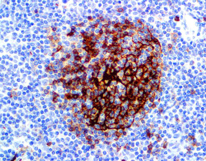 CD23 (C3B11), MMab