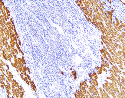 Hepatocyte (C4F5), MMab