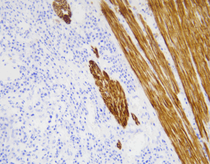 Desmin (C3B7), MMab