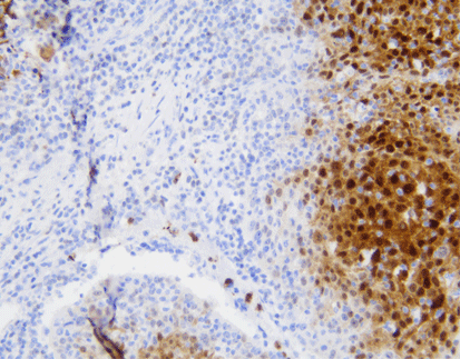 S100P(C5B10),MMab