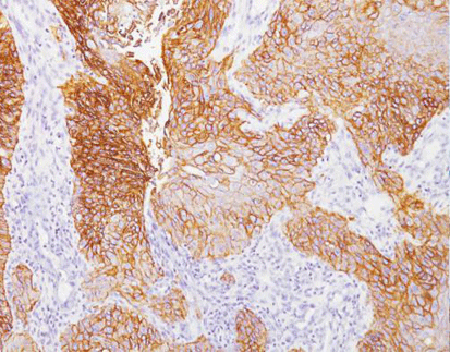 EGFR(EP22),RMab