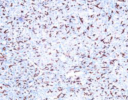 CD1a(C1E1),MMab