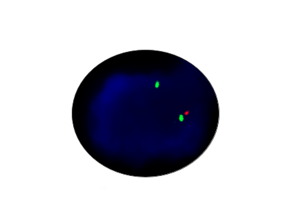 P53 Gene Detection Kit