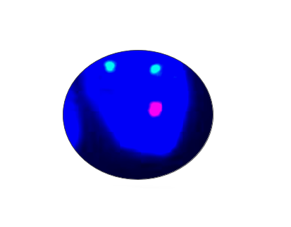 PTEN Gene Detection Kit