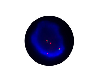 AURKA Genetic Amplification Detection Kit