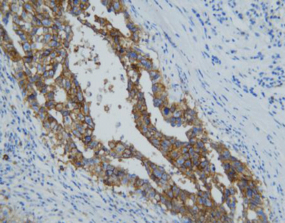 CD30(C5E10),MMab