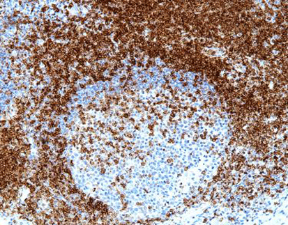 CD5 (C6A10), MMab