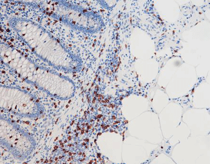 CD8(C2B11),MMab