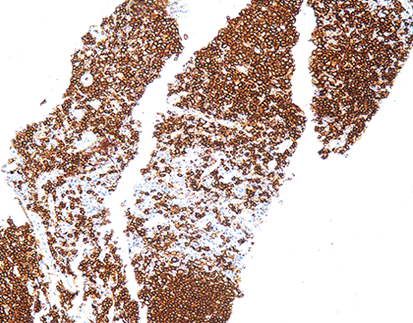 CD20(C4A11),MMab