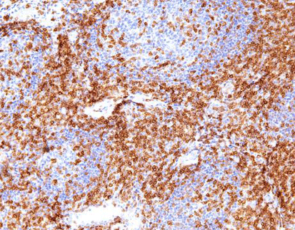 CD56 (C5A2), MMab