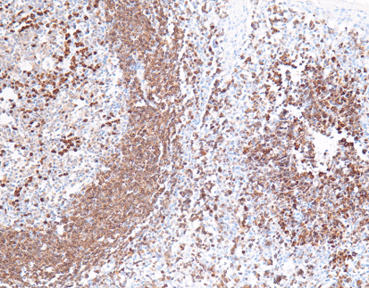 CD79a(C4C4),MMab