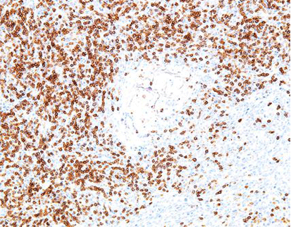 CD8(C9E28),RMab