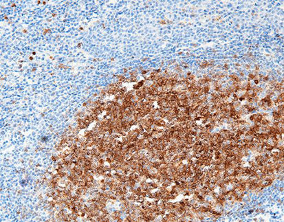 CD10(C6D1),MMab