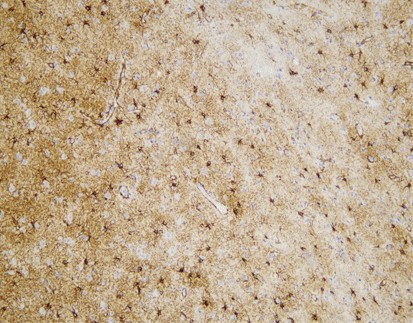 Glial Fibrillary Acidic Protein (C2C6), MMab