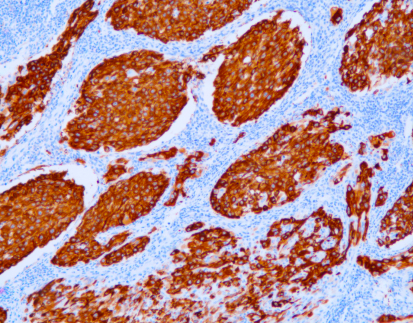 CD63(NK1/C3),MMab