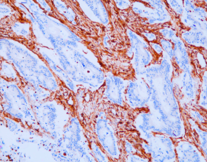 Vimentin(V9),MMab
