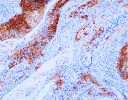 Smooth Muscle Myosin(C1B2),MMab