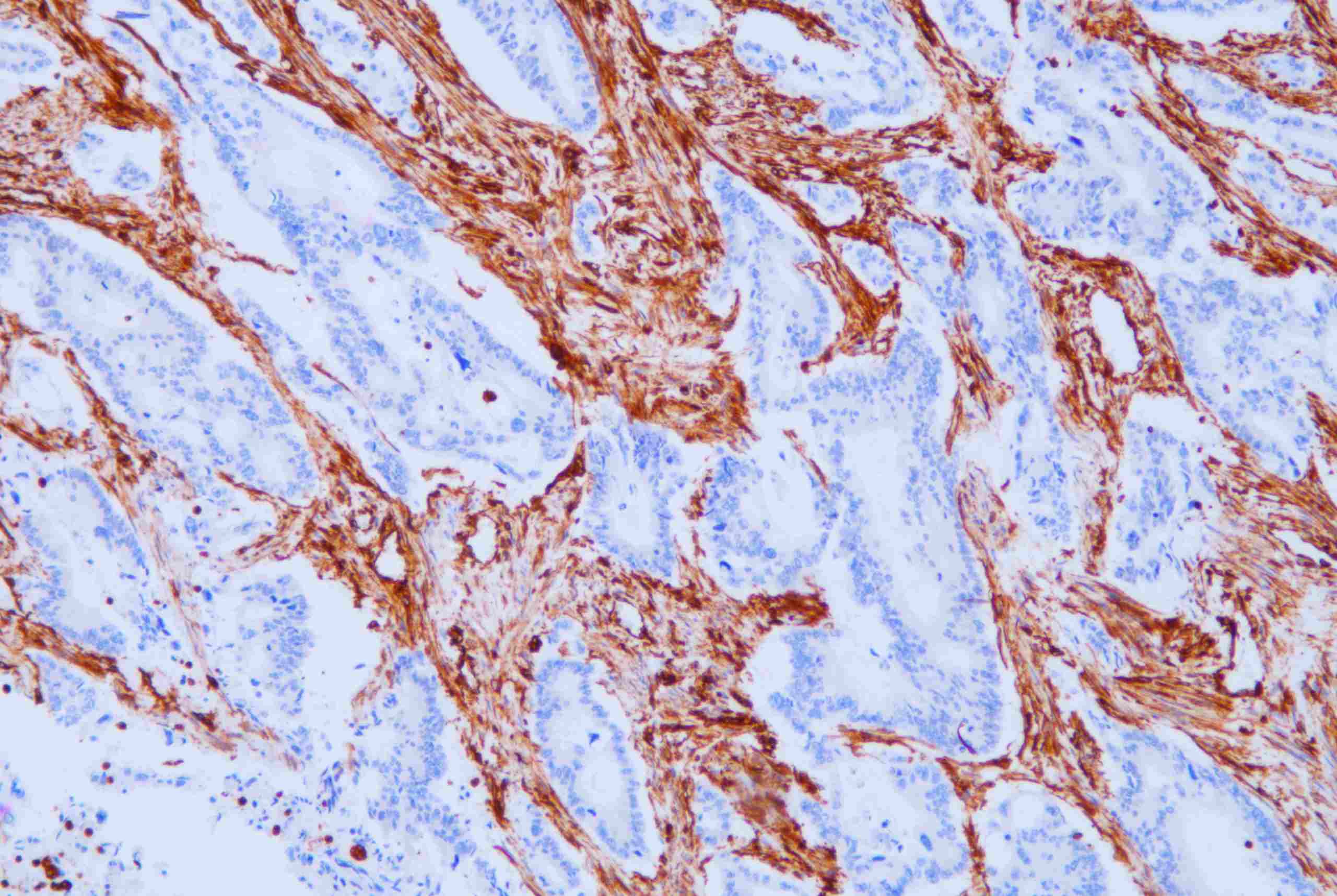 Vimentin(v9)