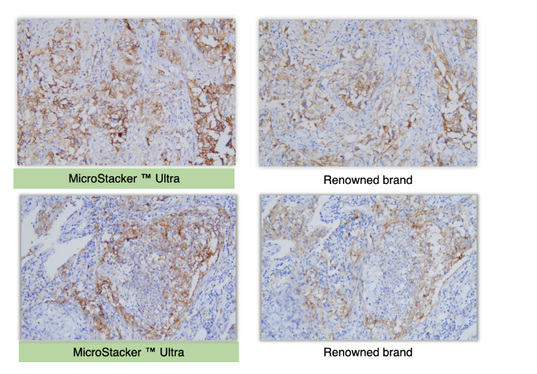 MicroStacker™ Ultra Polymer Detection Kit - High-Quality Staining Results